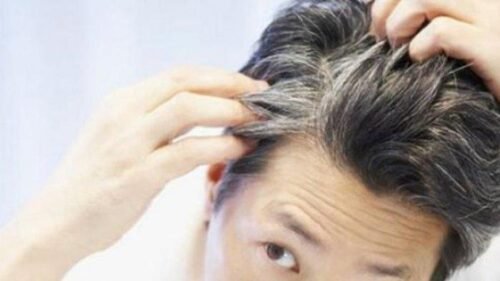 Rambut Beruban Di Usia Muda , Ini Faktor Penyebabnya :